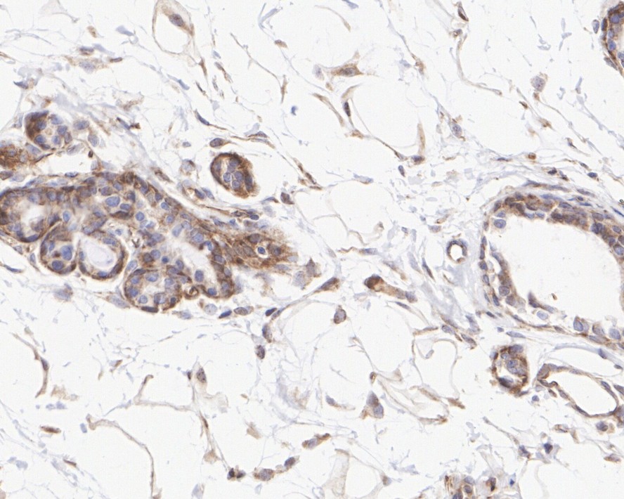 ET1607-71_15.jpg
