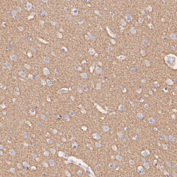 ET1608-46_2.jpg