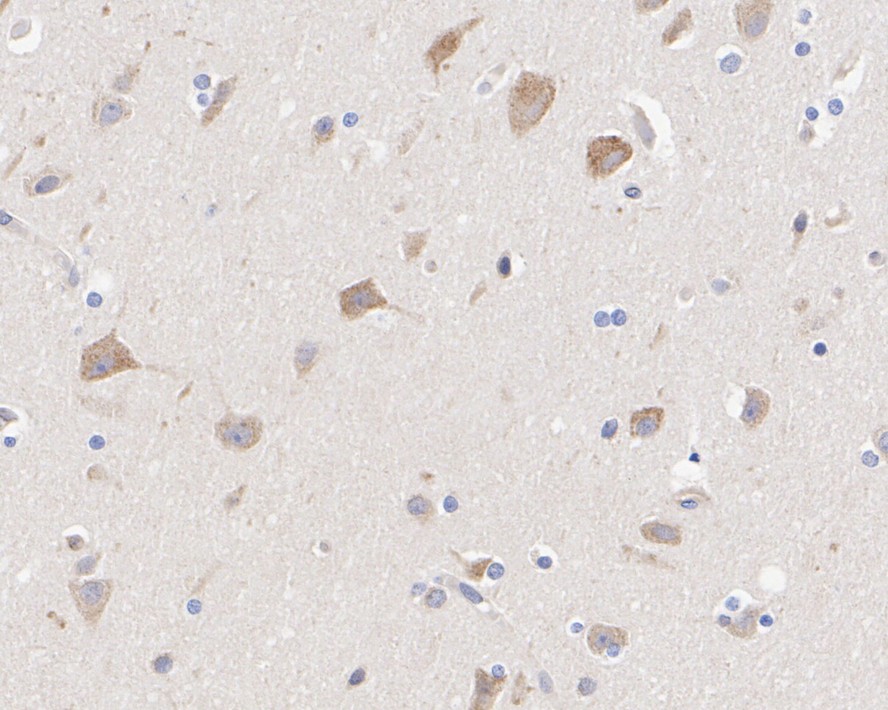 ET1610-11_6.jpg