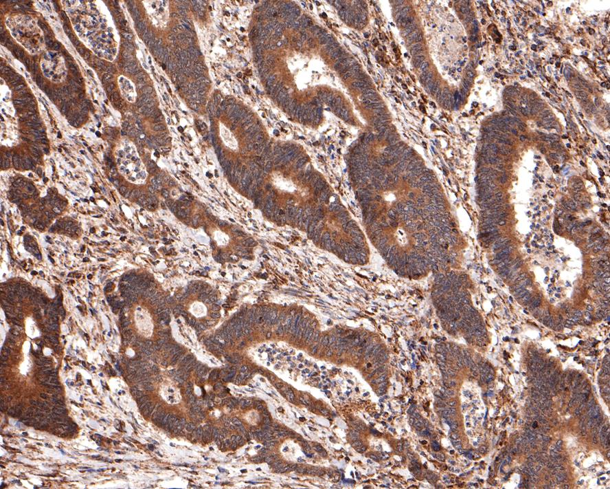 ET1610-93_5.jpg