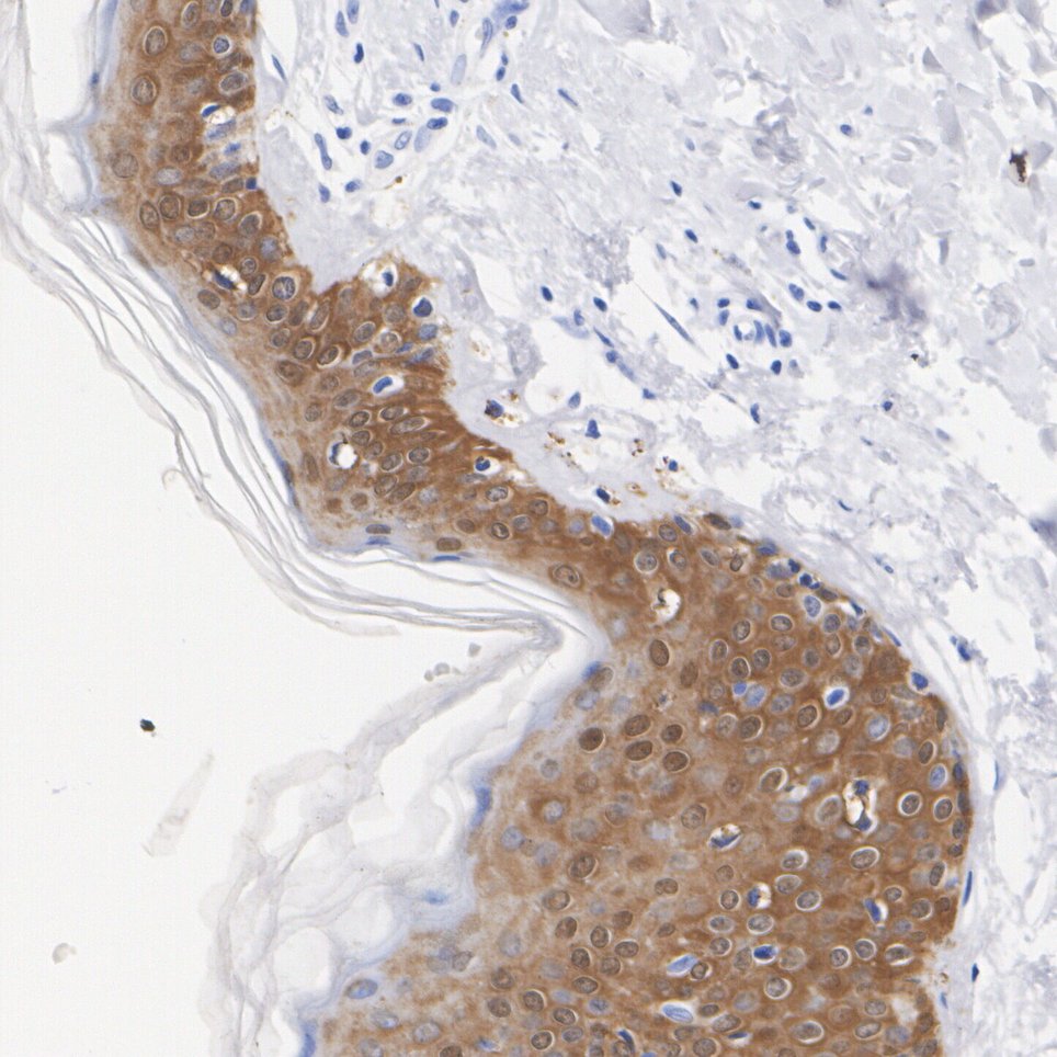 ET1612-41_2.jpg