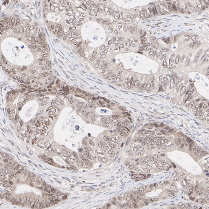 ET1612-51_2.jpg