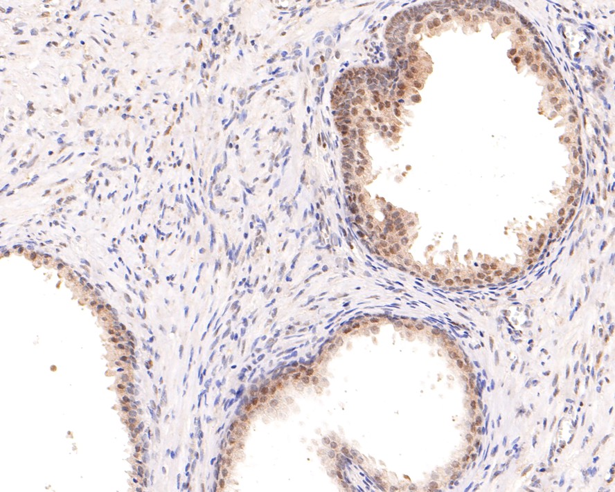 ET1612-94_4.jpg