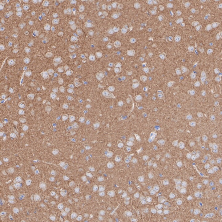 ET1701-16_2.jpg