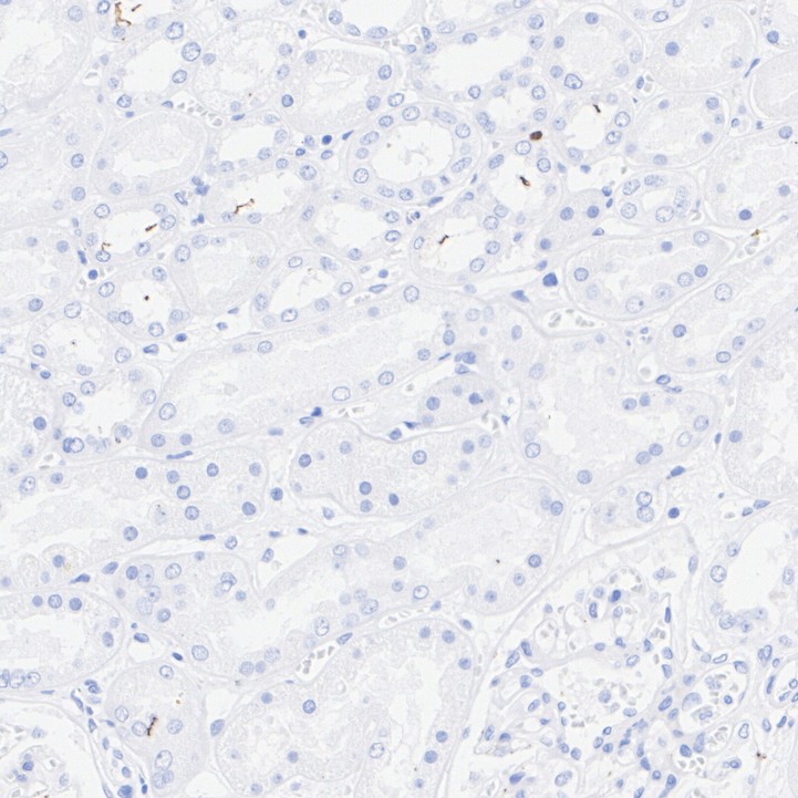 ET1701-49_12.jpg