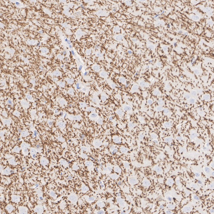 ET1702-15_11.jpg