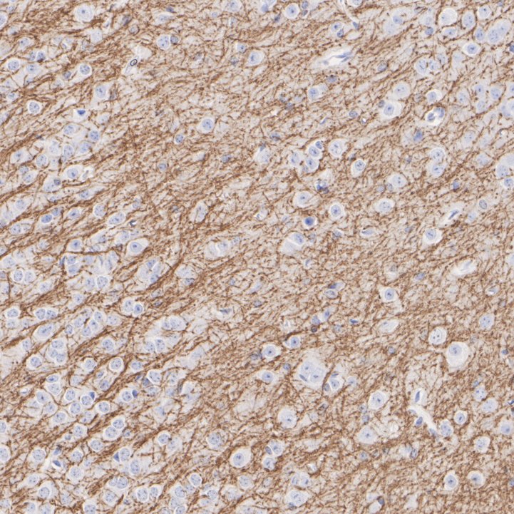 ET1702-15_9.jpg