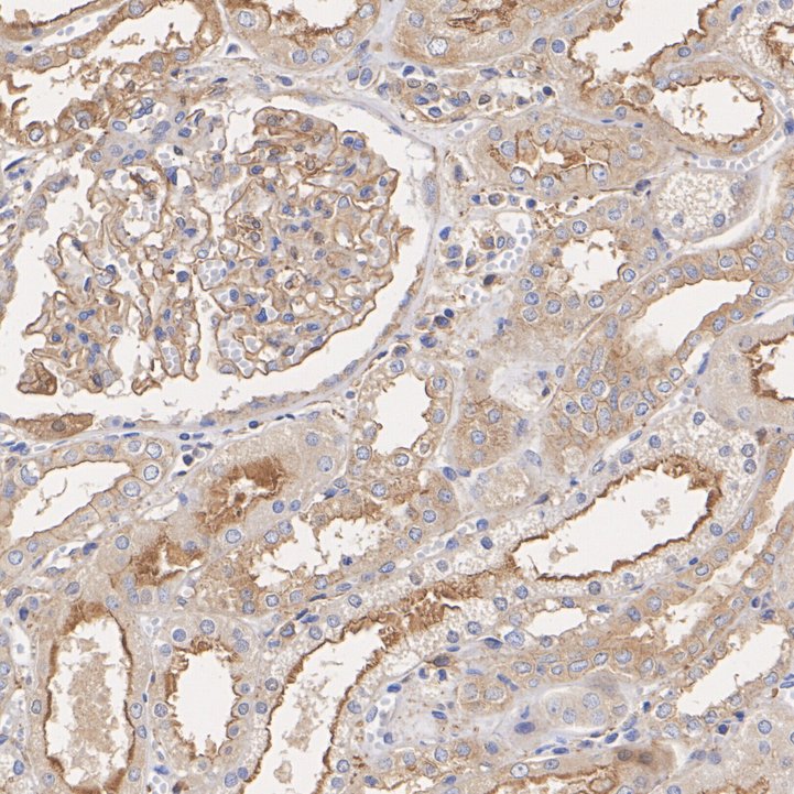 ET1703-65_6.jpg