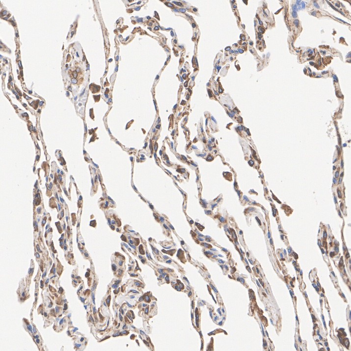 ET1703-96_5.jpg
