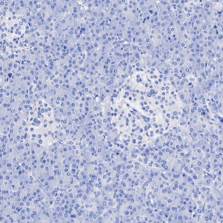 ET1705-13_6.jpg
