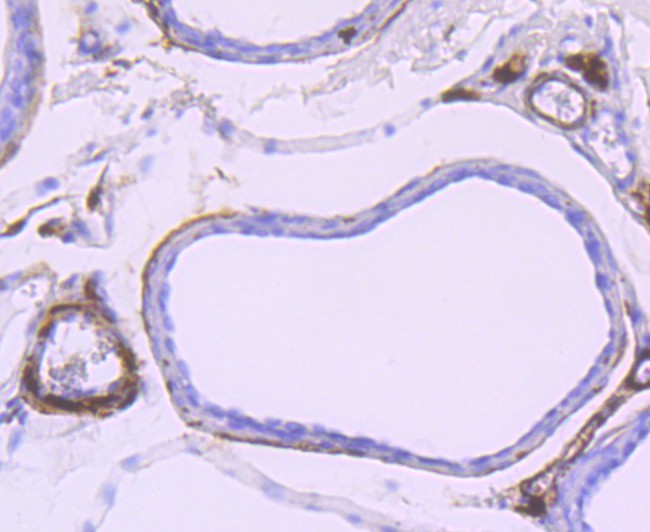 ET1705-48_6.jpg