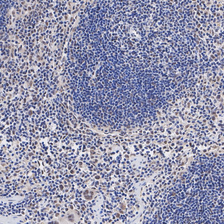 ET1706-52_10.jpg