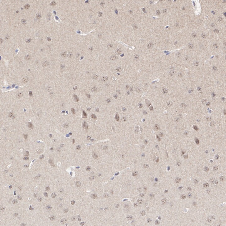 ET1706-52_9.jpg