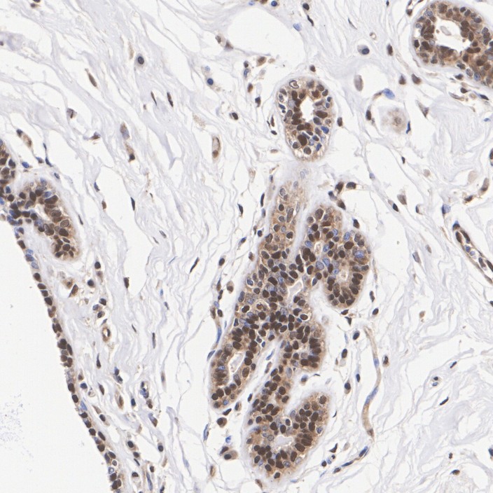 ET7106-56_2.jpg
