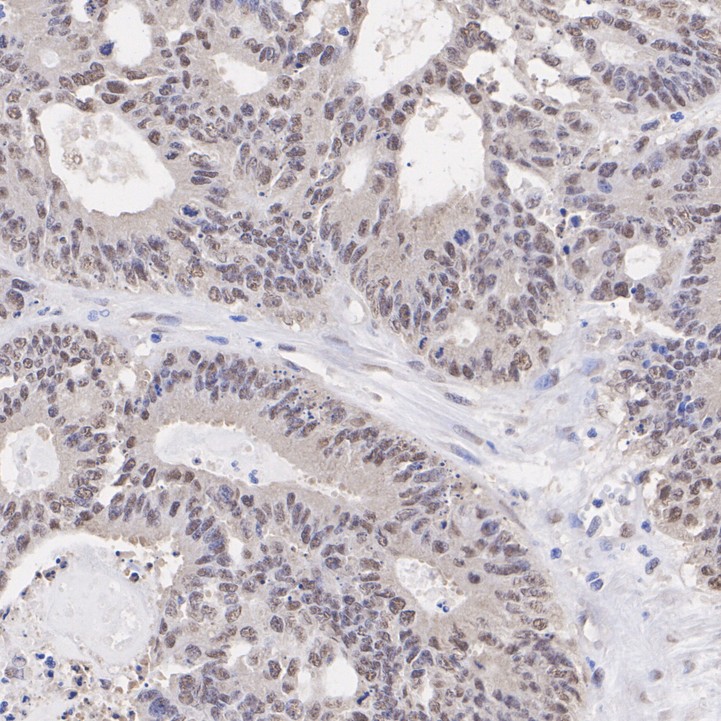 ET7106-56_3.jpg