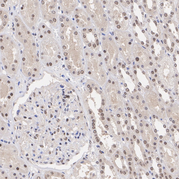 ET7106-56_4.jpg