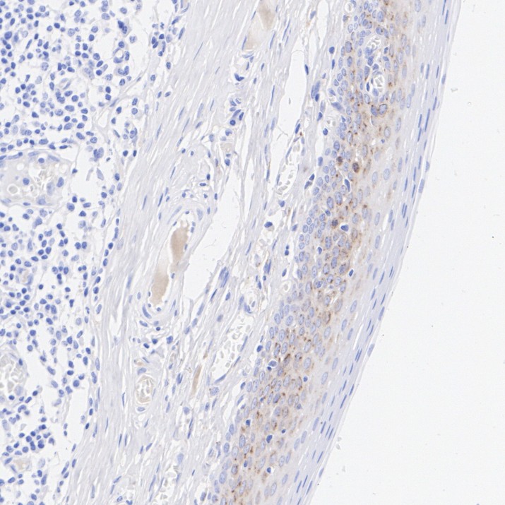 ET7106-63_3.jpg