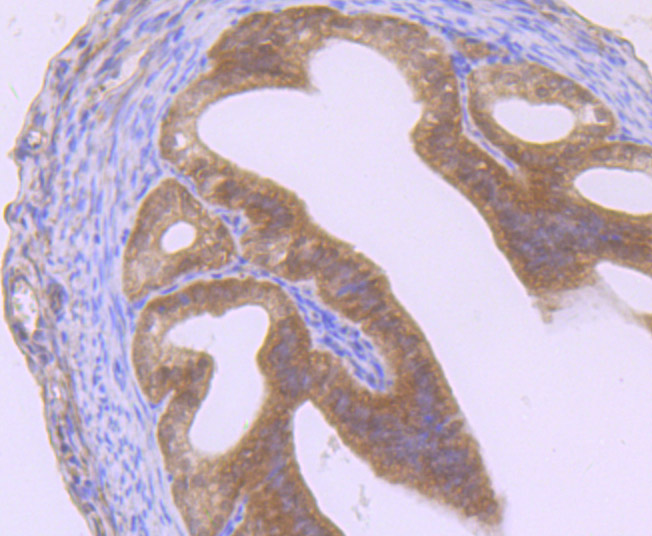 ET7106-91_5.jpg