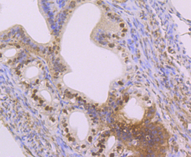ET7107-18_4.jpg