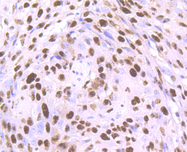 ET7107-18_5.jpg