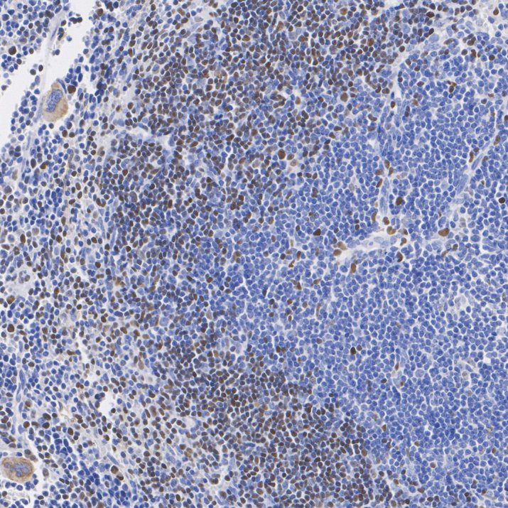 ET7107-38_5.jpg