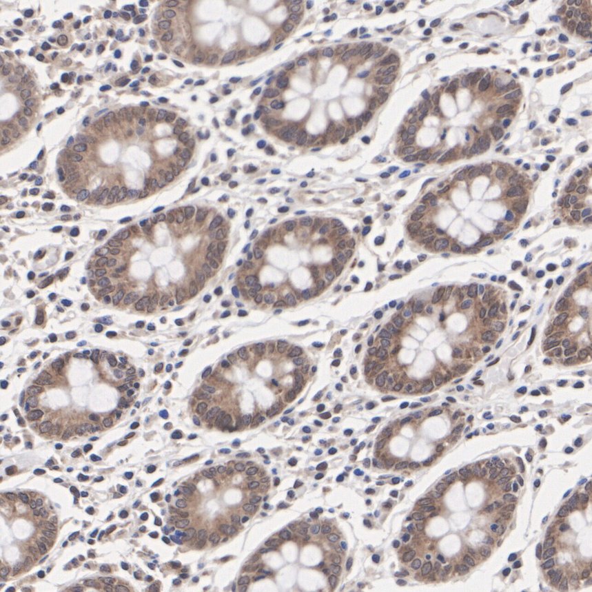 ET7109-12_4.jpg