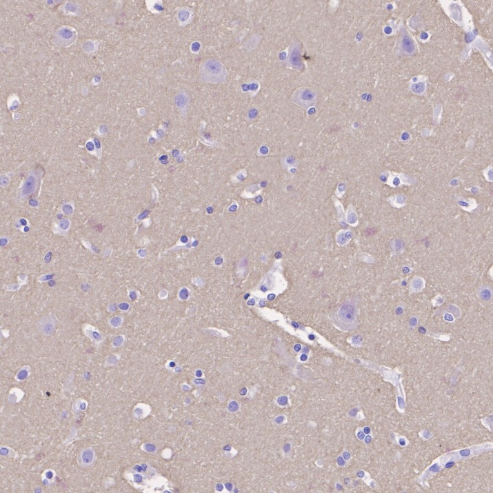 HA500380_2.jpg