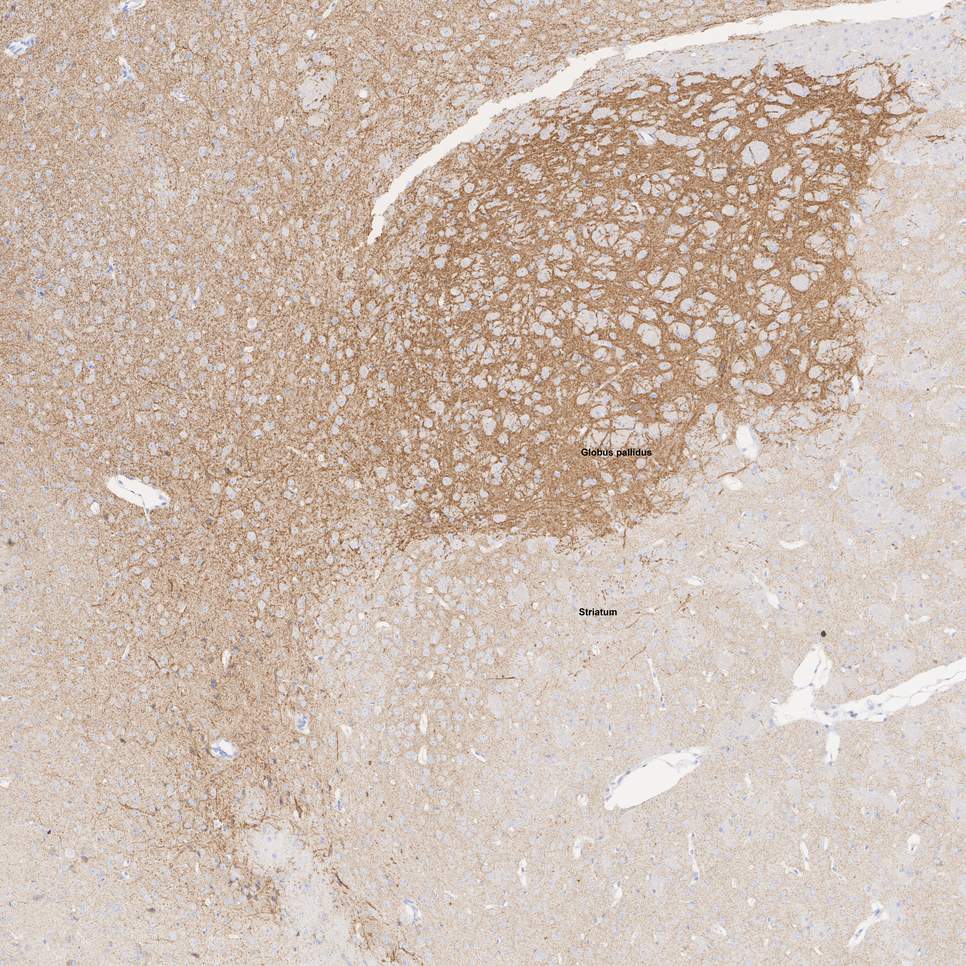 HA601372_1.jpg