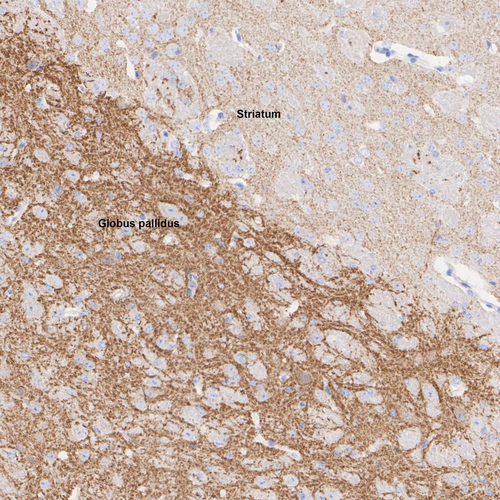 HA601372_2.jpg