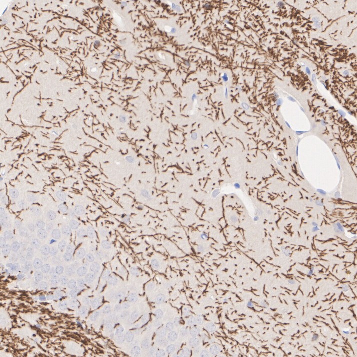 HA601407_5.jpg