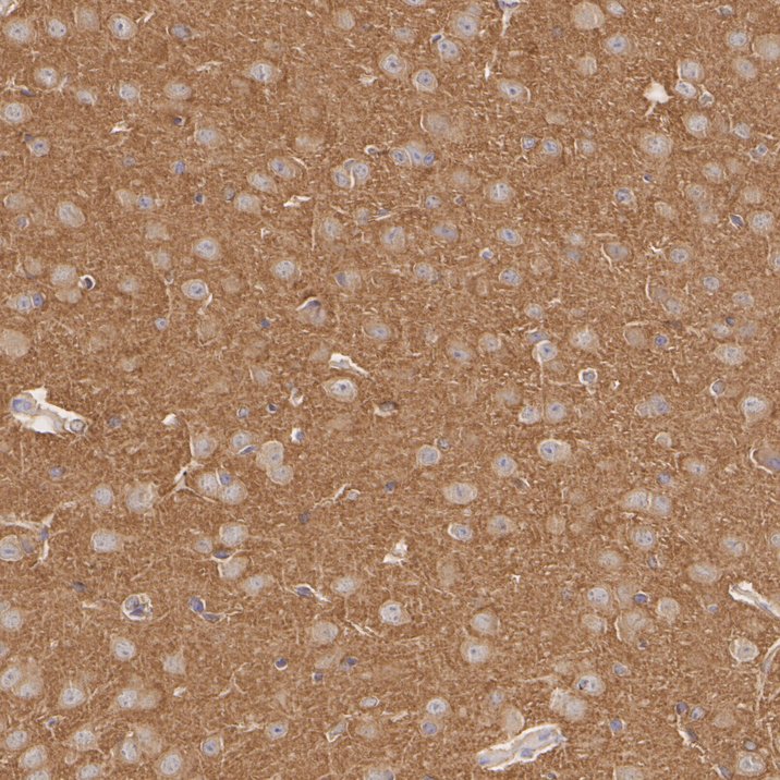 HA601415_2.jpg