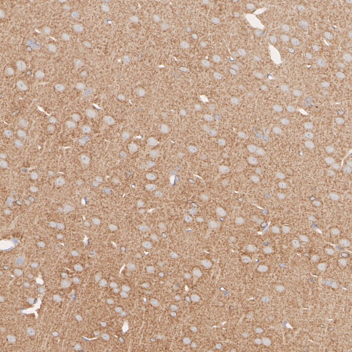 HA601415_4.jpg
