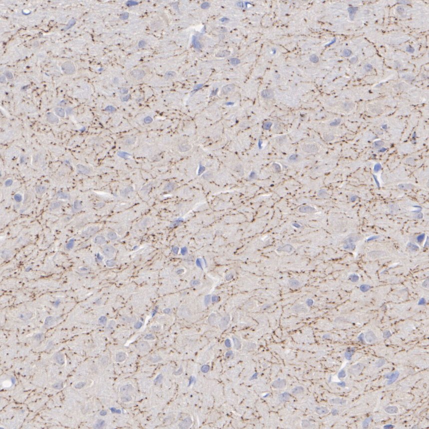 HA601494_3.jpg
