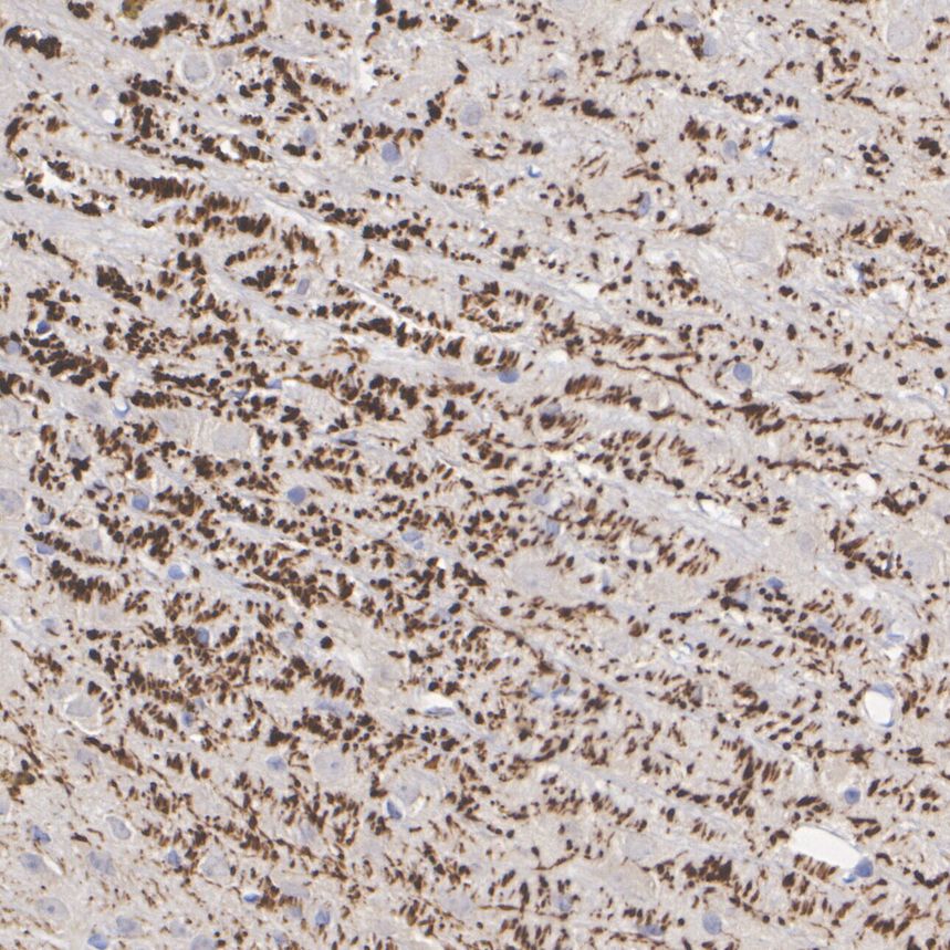 HA601494_4.jpg