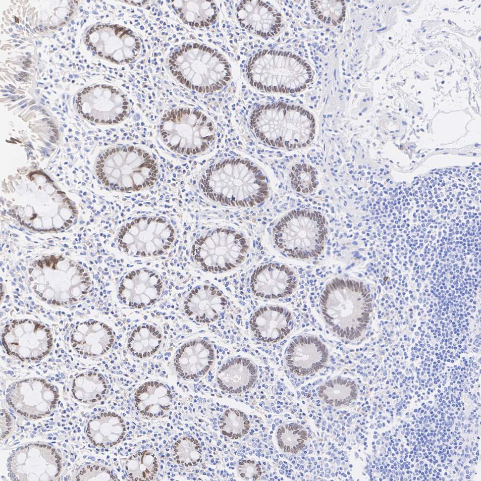 HA601626_2.jpg