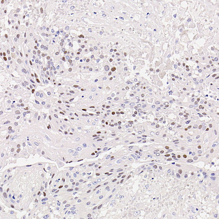 HA601648_1.jpg