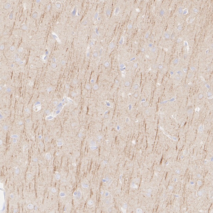 HA601664_5.jpg