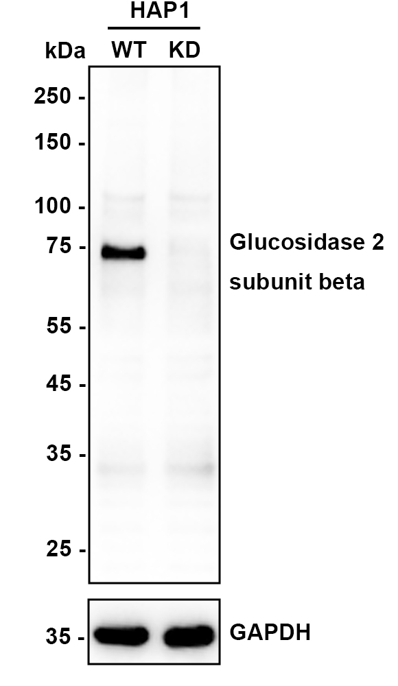 HA610151_2.jpg