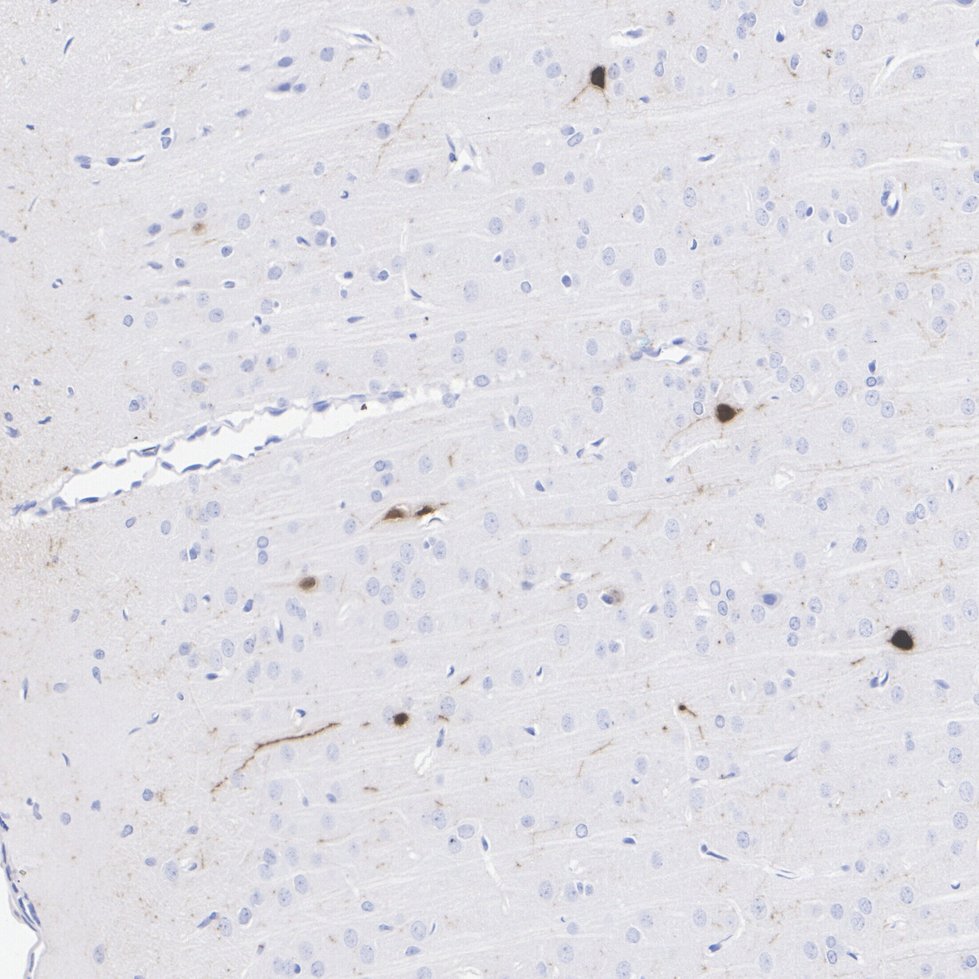 HA610215_6.jpg