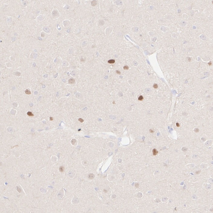 HA610219_5.jpg