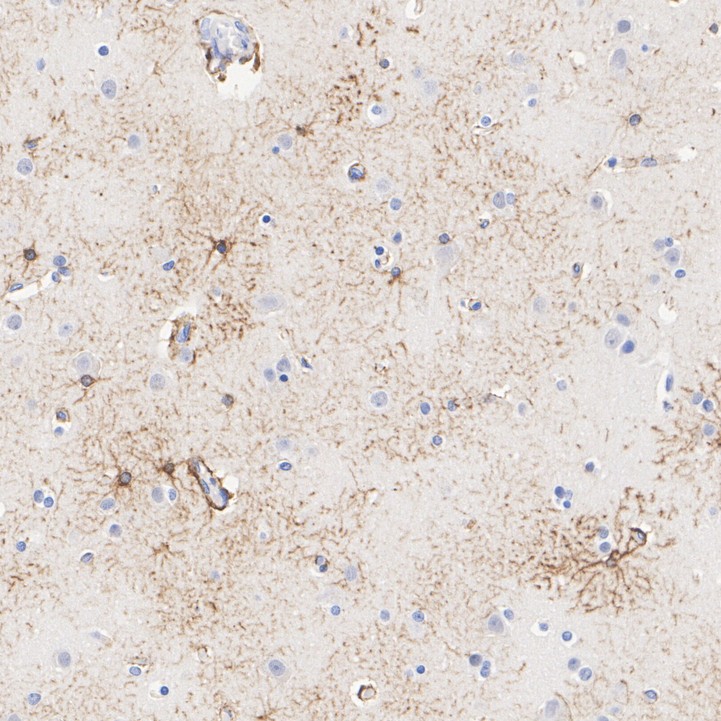 HA610317_2.jpg