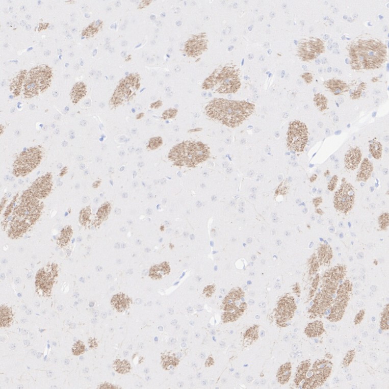 HA610336_2.jpg