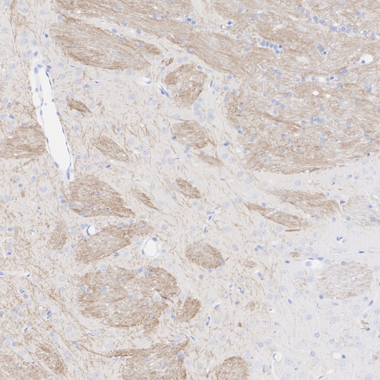 HA610336_3.jpg