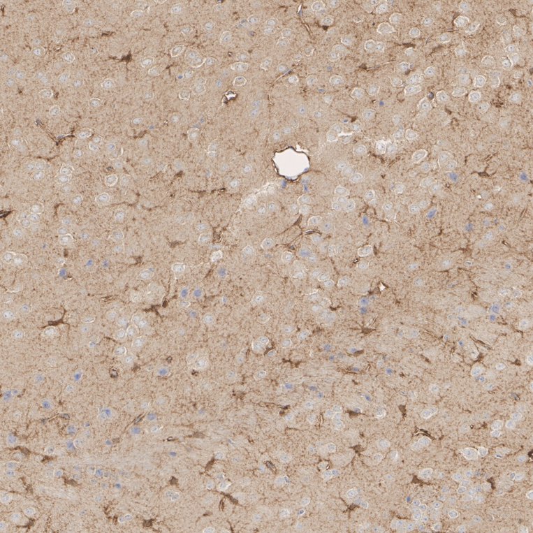 HA610342_2.jpg