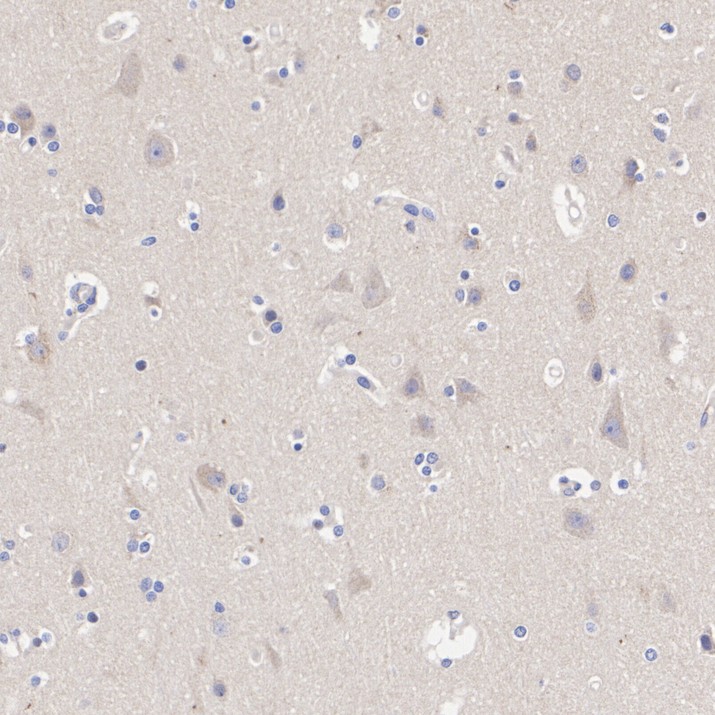 HA610410_2.jpg
