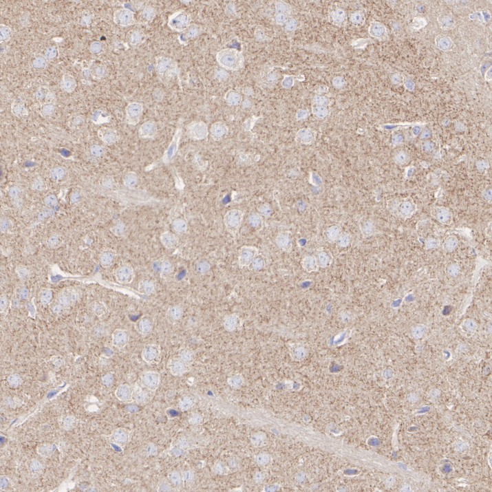 HA610410_3.jpg
