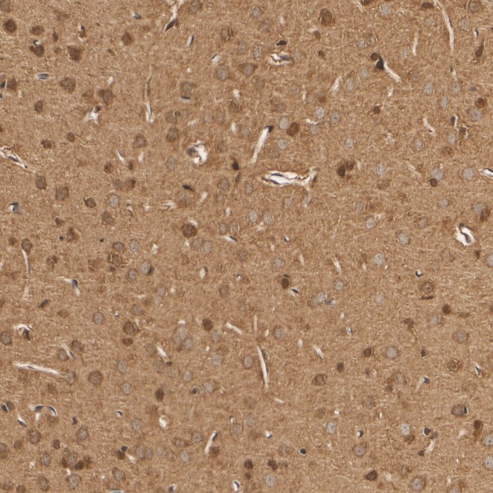HA610412_4.jpg
