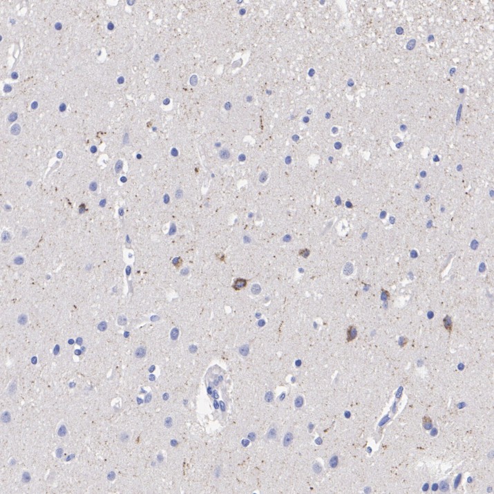 HA610417_3.jpg