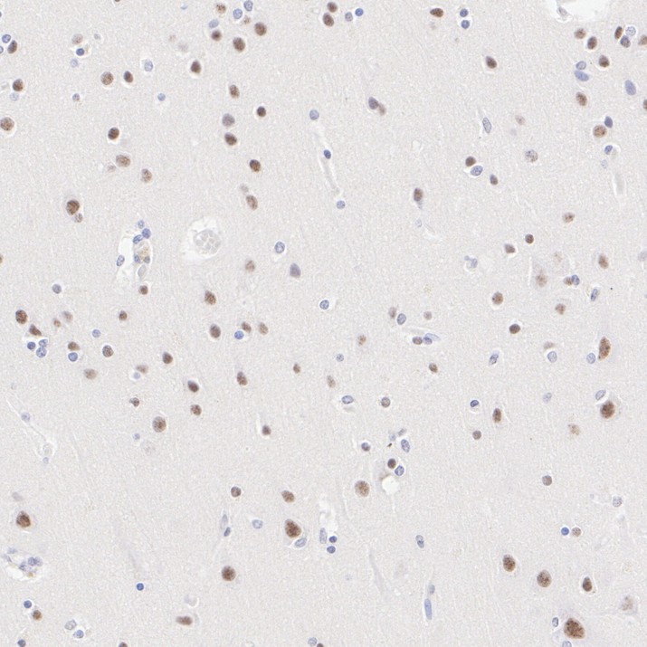 HA610425_2.jpg