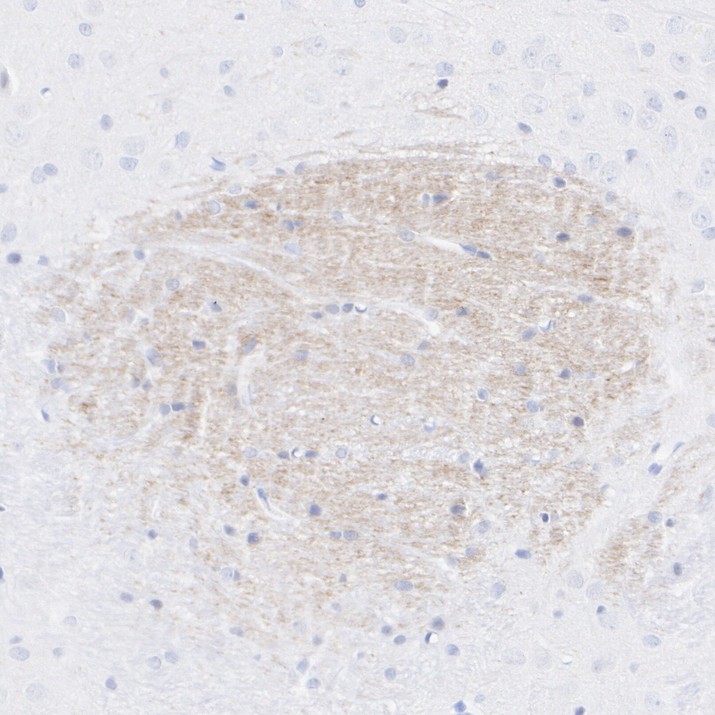 HA723755_4.jpg